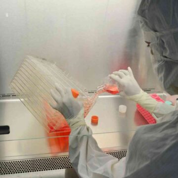 Alzheimer’s Symptoms Are Reversed in Mice After Gene Therapy Is Delivered Alzheimer’s Symptoms Are Reversed in Mice After Gene Therapy Is Delivered